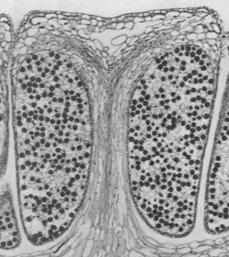 esporangioforo