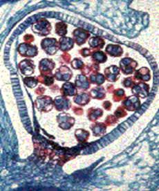 microsporangio