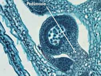 pedunculo